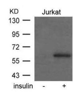 Western Blot DOK1 [p Tyr362] Antibody - BSA Free